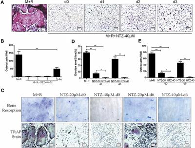 Nitazoxanide, an Antiprotozoal Drug, Reduces Bone Loss in Ovariectomized Mice by Inhibition of RANKL-Induced Osteoclastogenesis